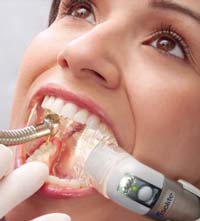 Isolite Illuminated Dental Isolation System-Daniel N. Galaif, D.D.S.-Encino Dentist