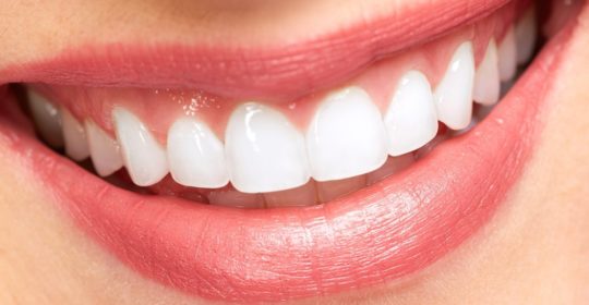 Health smile for individual with dental crowns