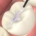 image showing applicaton of sealant on a tooth